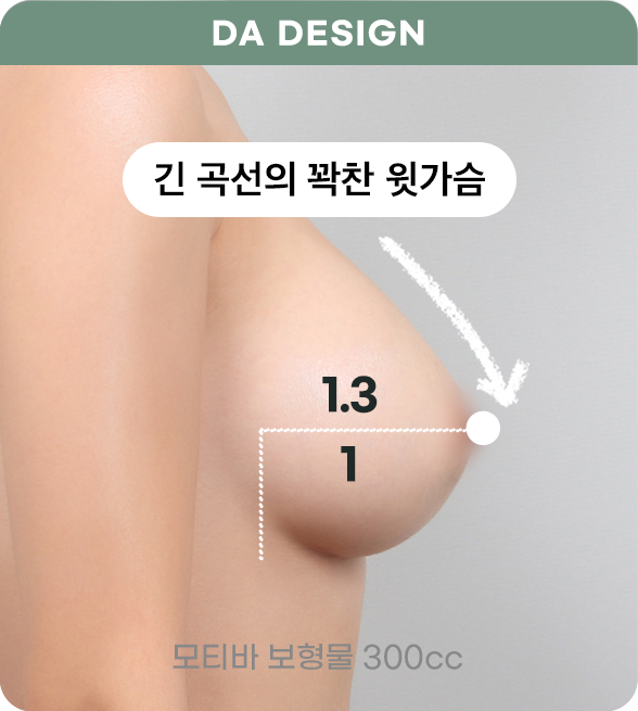 디에이 모티바 가슴성형