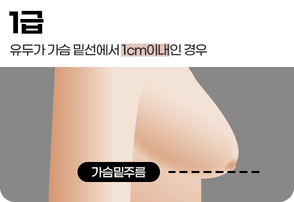 디에이 가슴 재수술