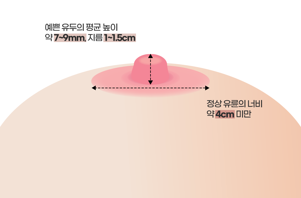 디에이 가슴 재수술