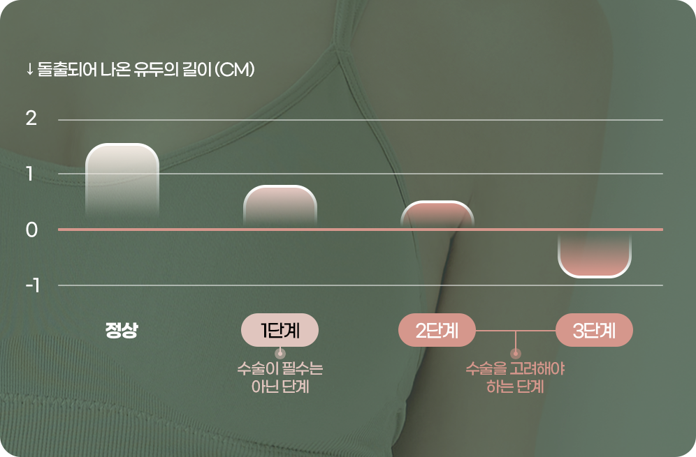 디에이 가슴 재수술