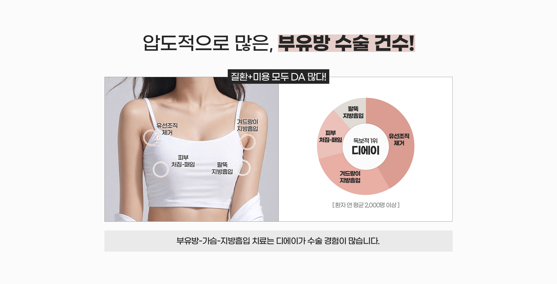 압도적으로 많은, 부유방 수술 건수!