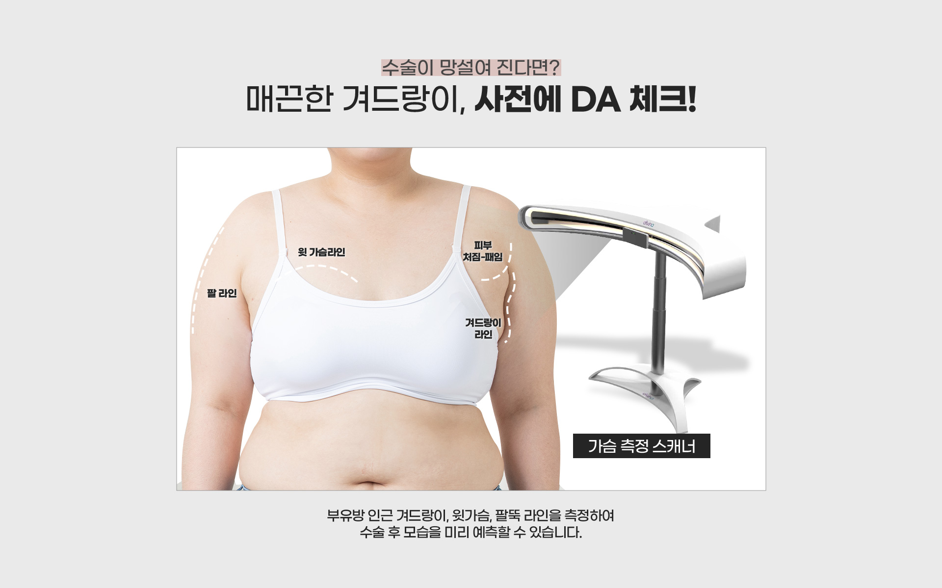 수술이 망설여 진다면? 매끈한 겨드랑이, 사전에 da 체크!