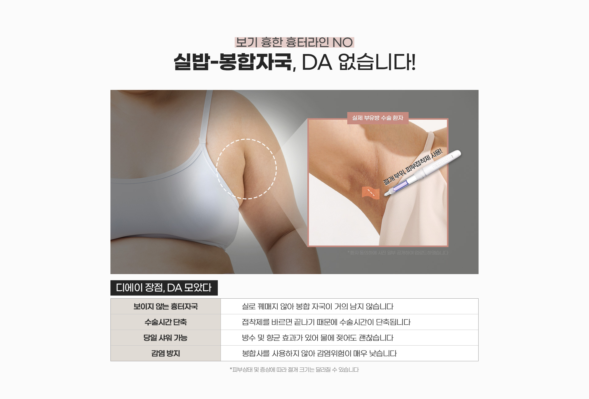 보기 흉한 흉터라인 NO 실밥-봉합자국, Da 없습니다!