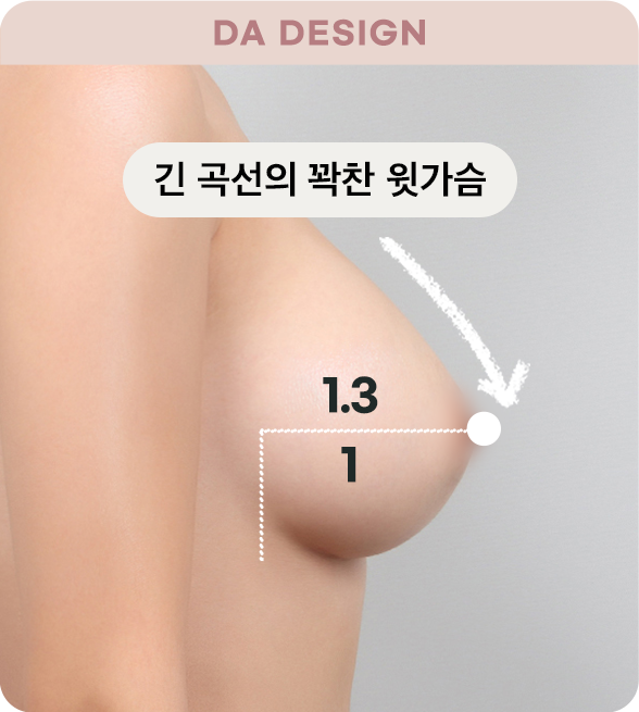 디에이 바운스 가슴성형