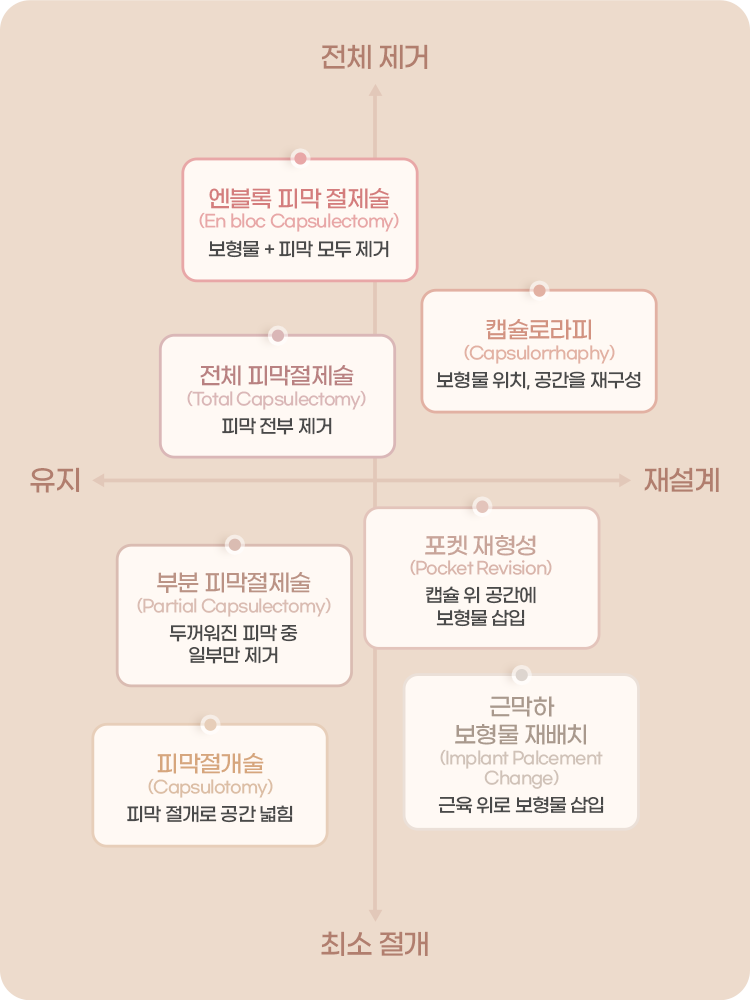 디에이 가슴재수술