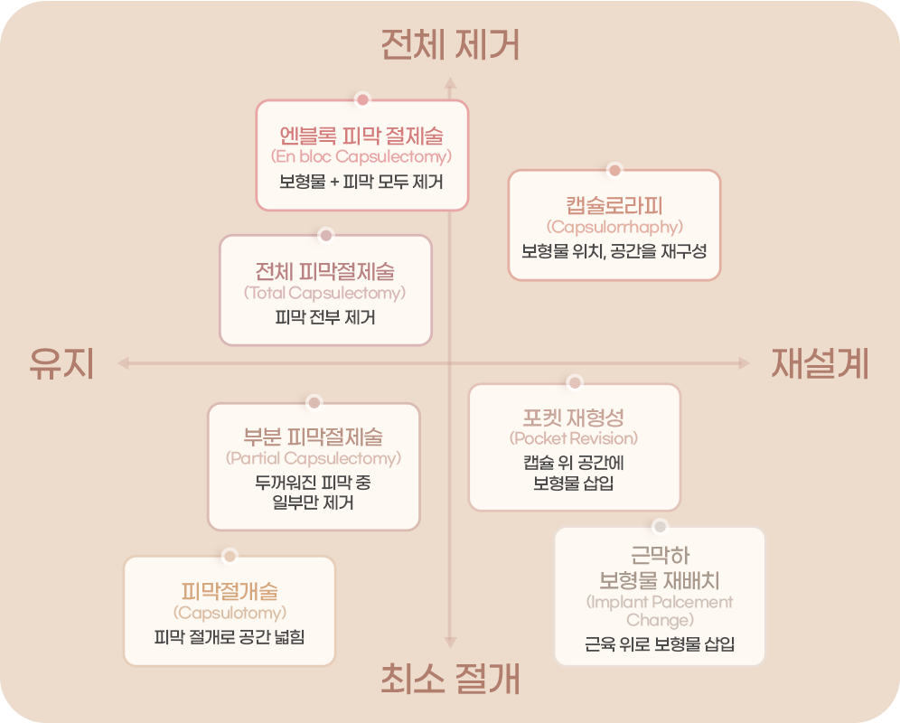 디에이 가슴재수술