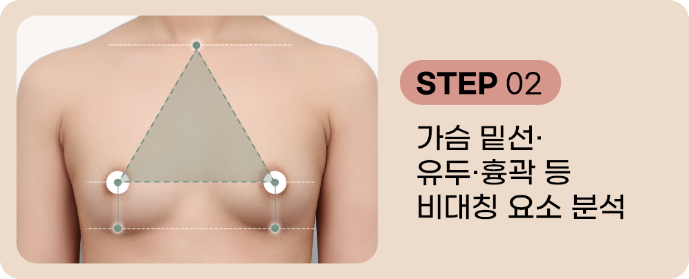 디에이 가슴 재수술