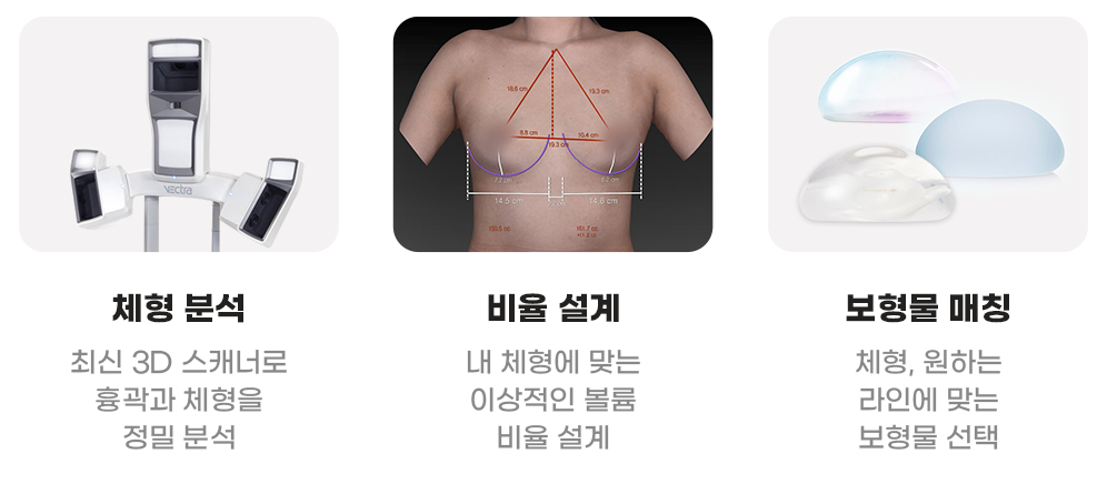 디에이 I라인 가슴성형
