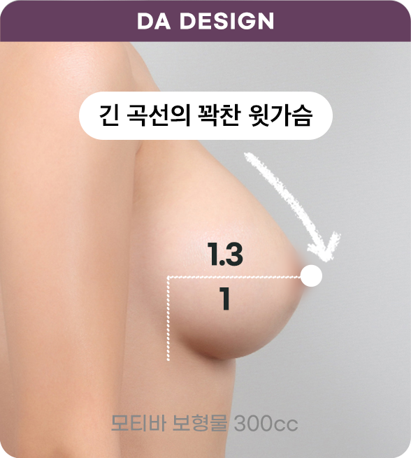 디에이 I라인 가슴성형