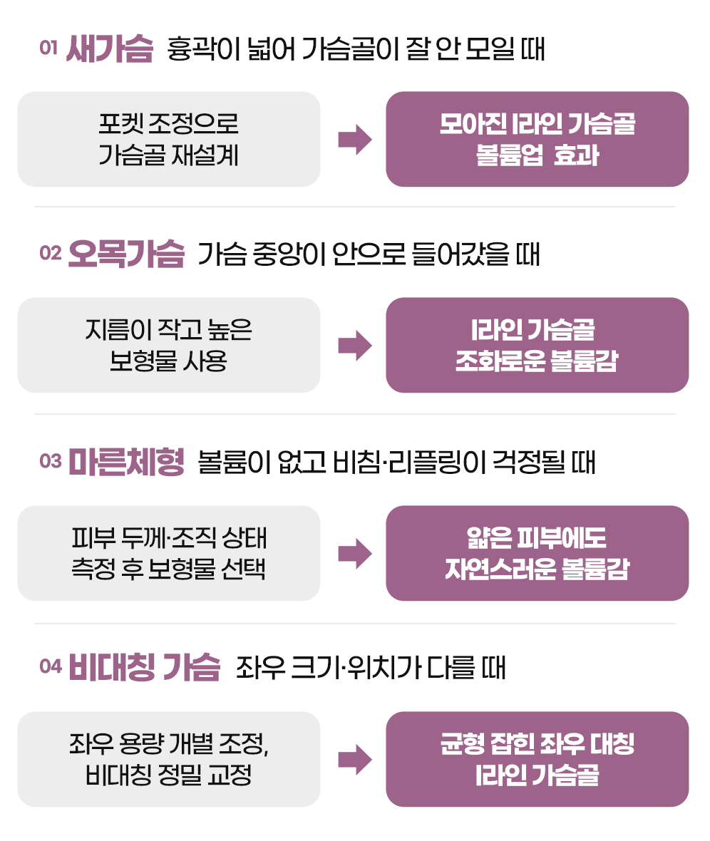 디에이 모티바 가슴성형
