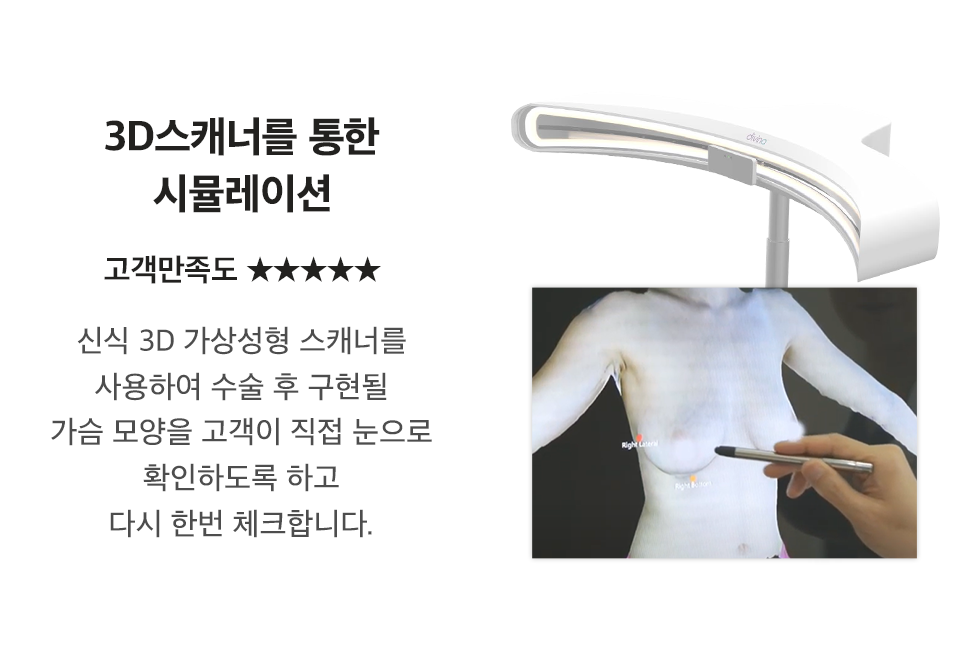 디에이 모티바 가슴성형