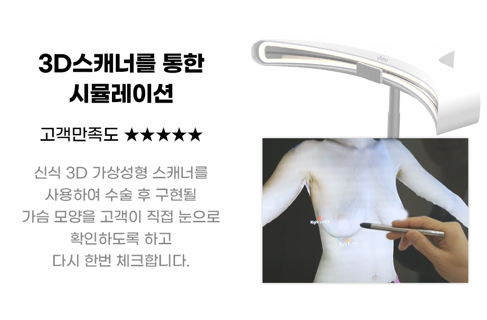 디에이 가슴성형