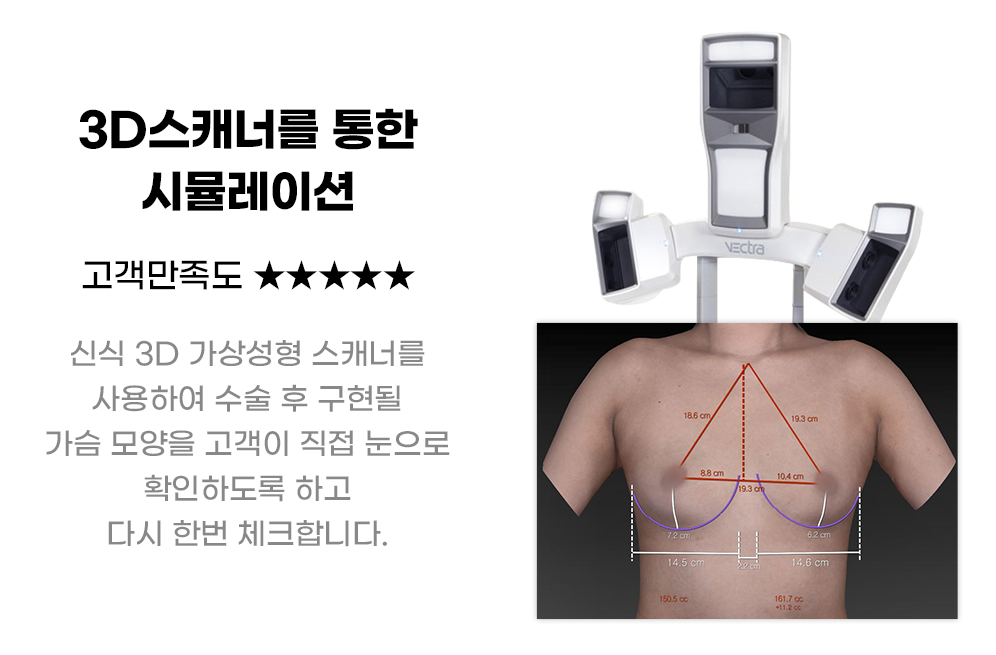 디에이 가슴성형
