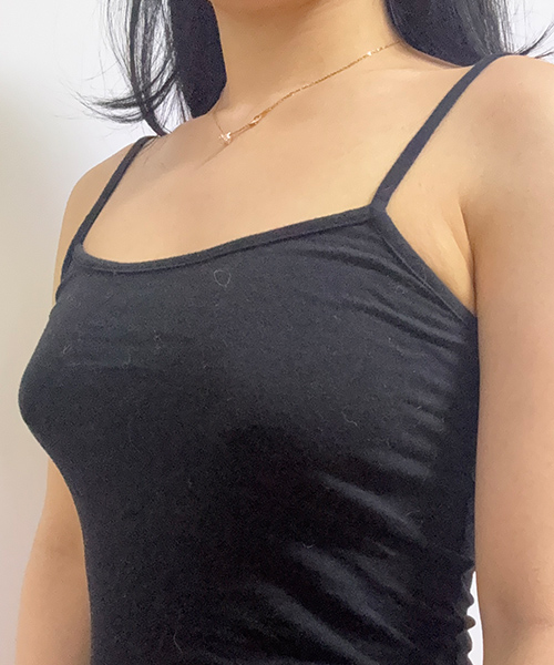 수술 전