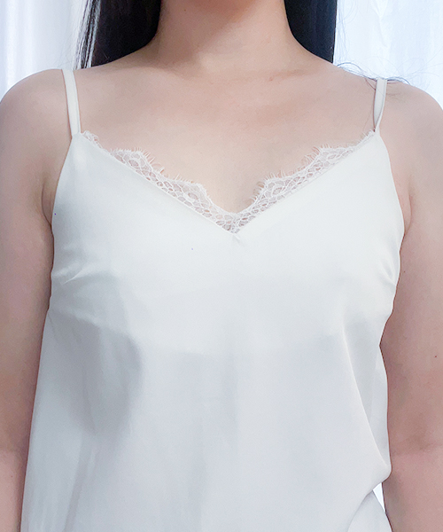 수술 전