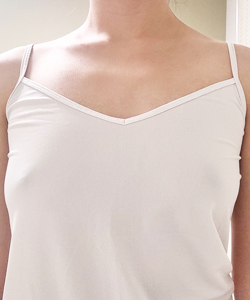 수술 전