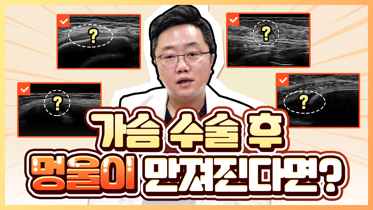 가슴 성형 후 멍울 유방암 가능성?